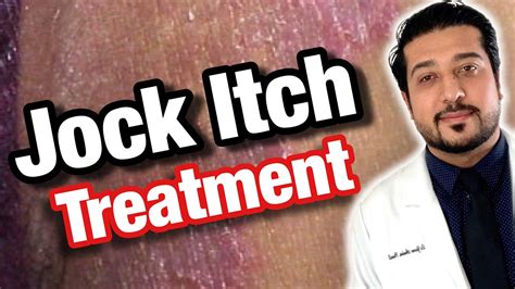 How To Treat Jock Itch Fast Jock Itch Treatment Causes And