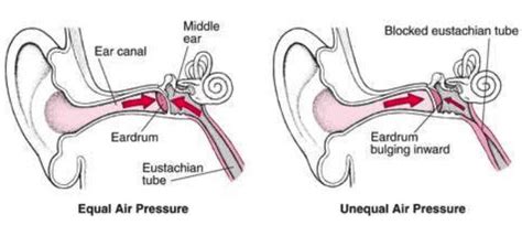 The Association Between Tinnitus The Neck And Tmj Msk Neurology