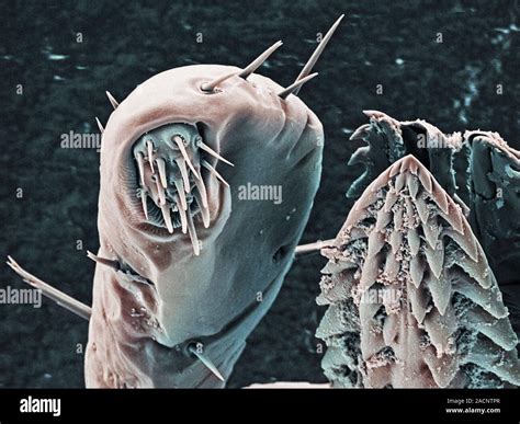 Tick Mouthparts Coloured Scanning Electron Micrograph Sem Of The