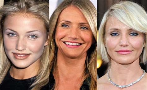 Cameron Diaz Plastic Surgery Before And After Pictures 2018