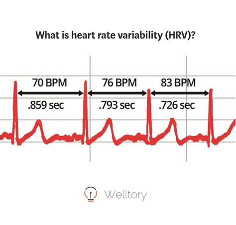 60 Bpm Heart Rate Photos Idea
