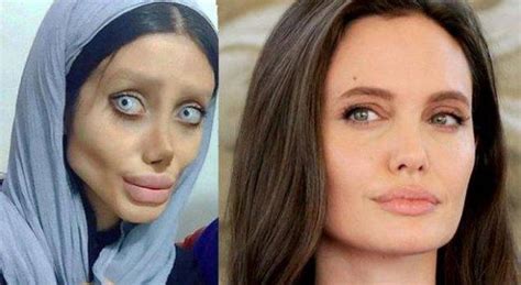 Эта девушка перенесла кучу операций чтобы стать похожей на Джоли