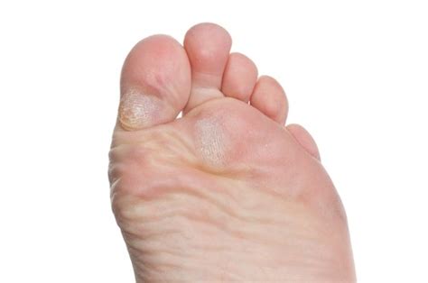 The Doctors Ipk Sweat Plugs In Foot Feels Like A Rock In Your Shoe