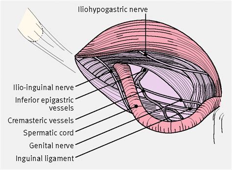 Open Inguinal Hernia Repair Anatomy