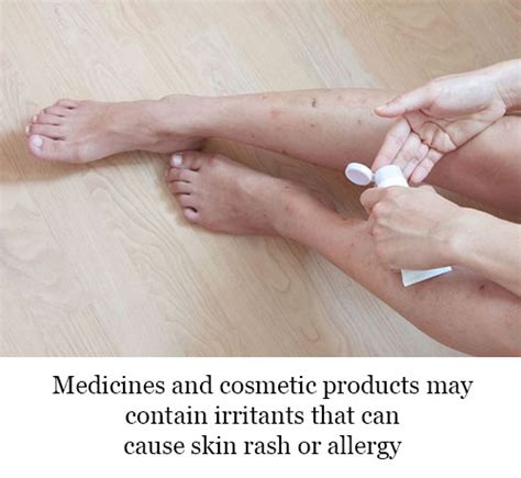 How To Get Rid Of Itchy Skin Rashes Or Allergies
