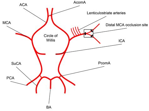 Modeling Stroke In Mice Permanent Coagulation Of The Distal Middle Cerebral Artery Protocol