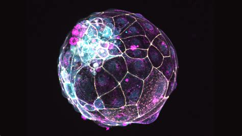 Blastoids Made Of Stem Cells Offer A New Way To Study Fertility