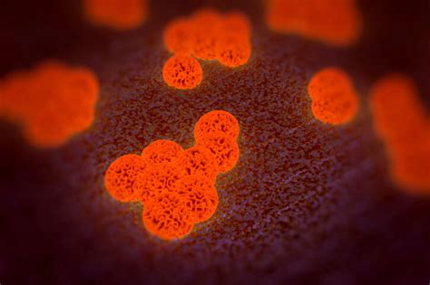 Mrsa causes mainly skin infections in nonhospitalized people; The Dangers of MRSA Bacteria | Superpages
