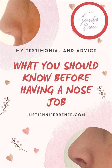 Click To Read What I Wish I Knew Before Getting A Nose Job And Testimonial To How Mine Went
