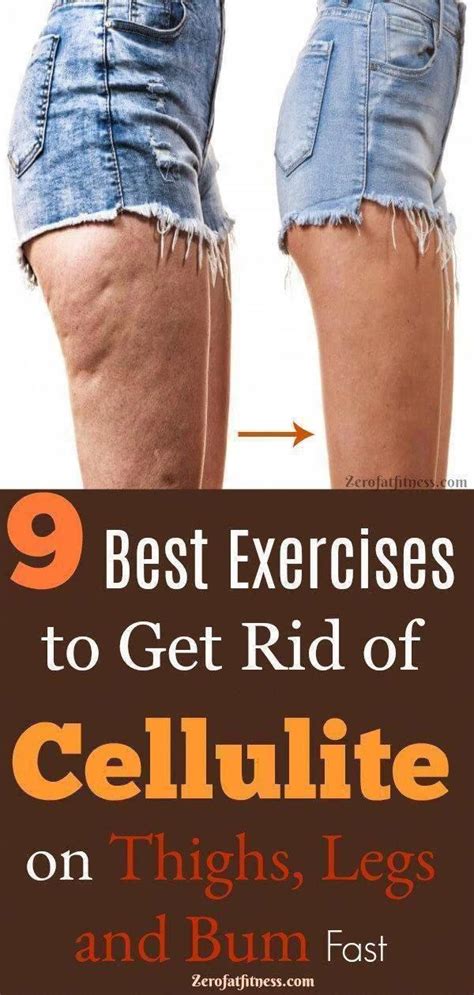 Pin On Eliminate Cellulite