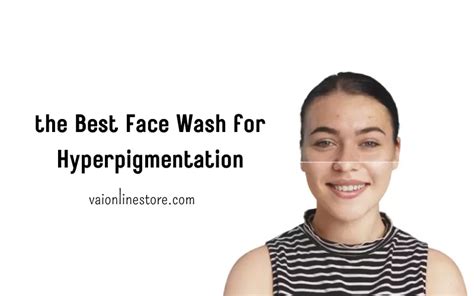 Discover The Best Face Wash For Hyperpigmentation Today 2024