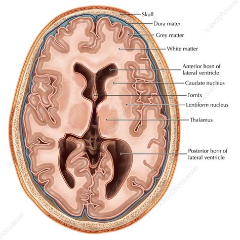 Transverse Section Of The Brain Stock Image C022 1136 Science