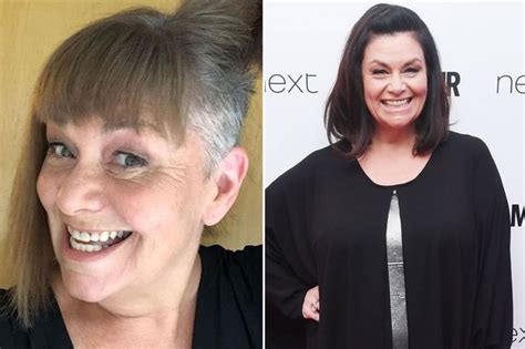 Dawn French Embraces Grey Hair As She Reveals Shaved Transformation