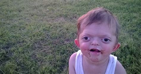 Mom Responds To Bullies Who Made Cruel Meme Of Son With Rare Disorder