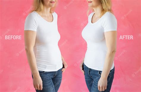 mulher antes e depois da cirurgia plástica do realce do peito foto premium