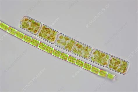 Diatoms And Filamentous Green Algae Light Micrograph Stock Image