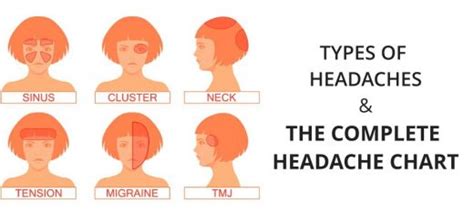 Headache Chart Types Of Headaches Causes Symptoms Treatments Prevention