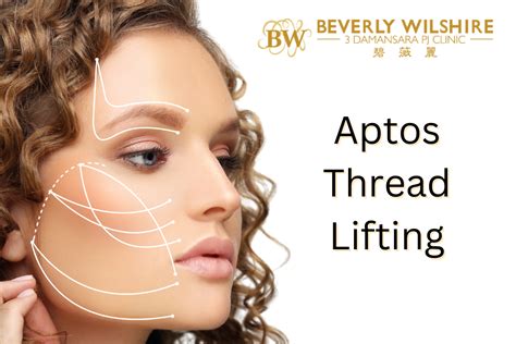 All You Need To Know About Aptos Thread Lifting Beverly Wilshire Clinic