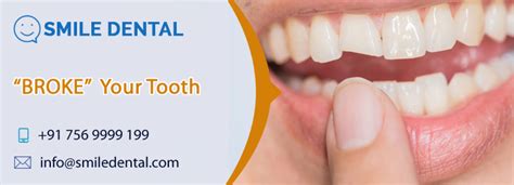 Broken Tooth Pain Relief Treatment In Dilsukhnagar Smile Dental