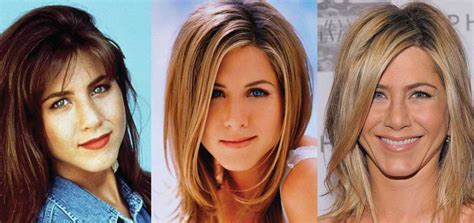 Jennifer Aniston Plastic Surgery Before And After Pictures 2024