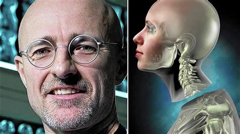 What Happened To The First Human Head Transplant Youtube