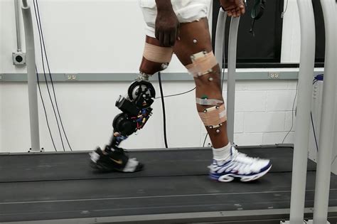 Robotic Prosthetic Leg Uses Stronger Motors For Better Performance