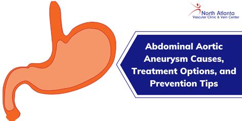 Abdominal Aortic Aneurysm Warning Signs