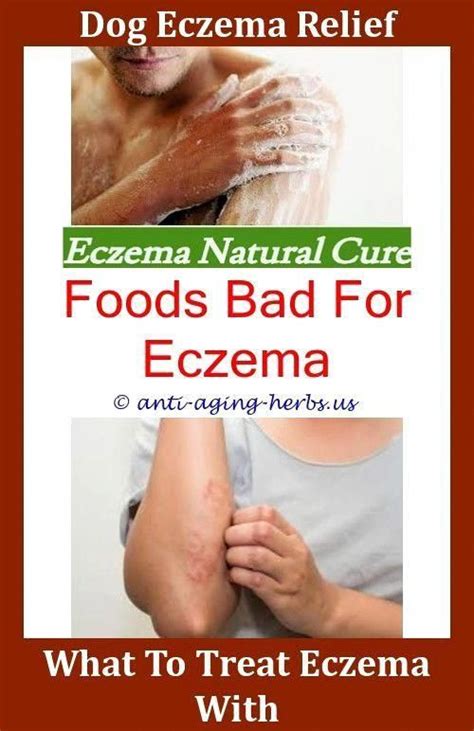 Id9587113853 Fastgrowinggrapevines Eczema Eczema On Hands Eczema
