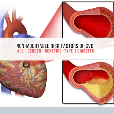 What Are Non Modifiable Risk Factors Cvd And Heart Disease Risk