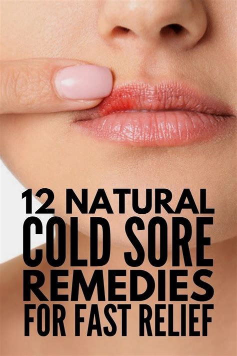 Pin By Lehaantuzinskiy On Beauty Cold Sores Remedies Natural Cold