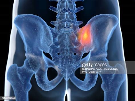 Sacroiliac Pain Photos And Premium High Res Pictures Getty Images