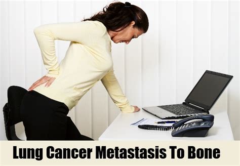 Check spelling or type a new query. 6 Signs And Treatments Of Metastasis Of Lung Cancer ...