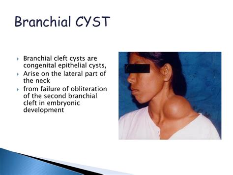Ppt Differential Diagnosis Of Anterior Neck Swelling Powerpoint My