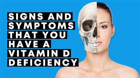 Vitamin D Deficiency 8 Signs And Symptoms YouTube