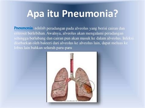 Pneumonia Adalah Penyakit Homecare24