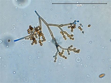 Fun With Microbiology Whats Buggin You Cladosporium Species