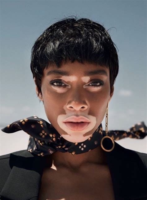 Winnie Harlow Chantelle Brown Young Pretty People Beautiful People