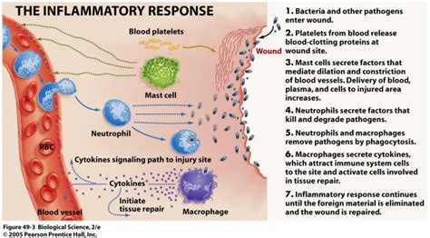 The Inflammatory Response