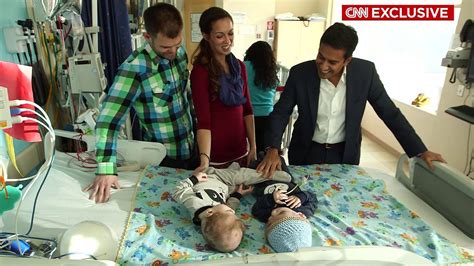 Successfully Separated Conjoined Twins Jadon And Anias Mcdonald Getting