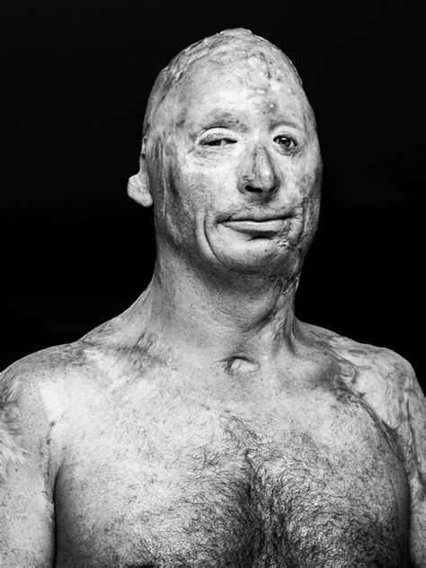 Heres What The Scars Of Our Veterans Tell The World Gallery Ebaum