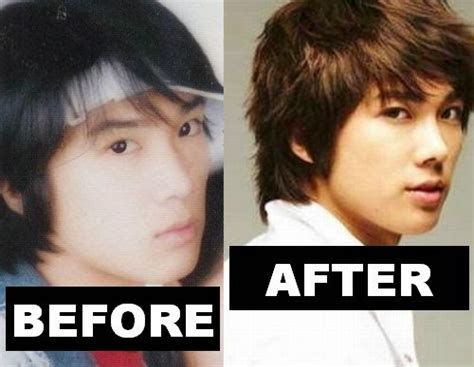 Kim Hyun Joong Plastic Surgery Before And After Pictures