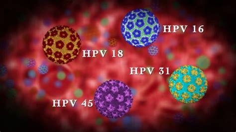 Erkeklerde Görülen HPV 16 18 Kondiloma acumulata Virüsünün Tanısı ve