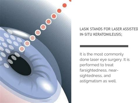 PPT A Guide To Bladeless Lasik Eye Surgery PowerPoint Presentation