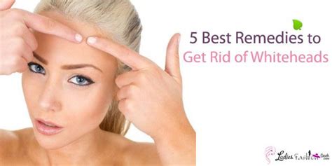 5 Best Remedies To Get Rid Of Whiteheads Whiteheads Rid Remedies