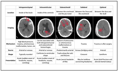Brain Sciences Free Full Text An Efficient Framework To Detect
