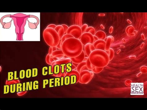 Why Blood Clots During Period Health And Sex Education Clear And Remove