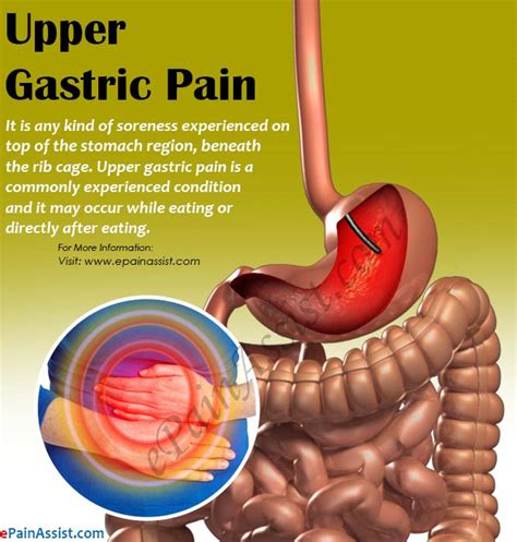 Upper Gastric Pain 11 Causes Of Pain On Top Of The Stomach