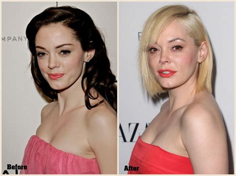 Rose Mcgowan Plastic Surgery Before And After Photo 2013 2014