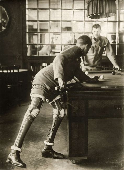 World War I Soldier A Double Amputee Plays Billiards With Prosthetic