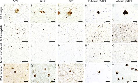 Immunohistochemical Staining Of Brain Tissue Using Ps129 α Syn